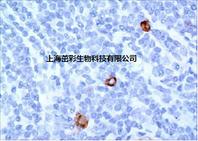 肥大细胞染色.png